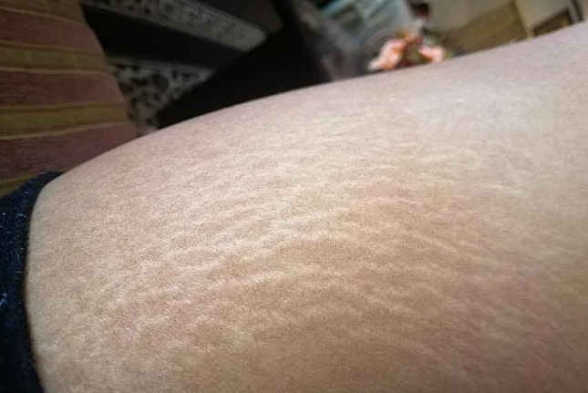 广州肤康皮肤病医院