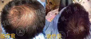 广州肤康皮肤病医院
