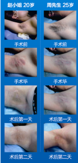 广州肤康皮肤病医院
