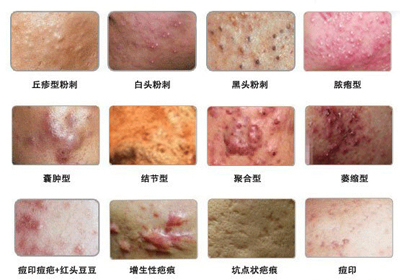 广州肤康皮肤病医院