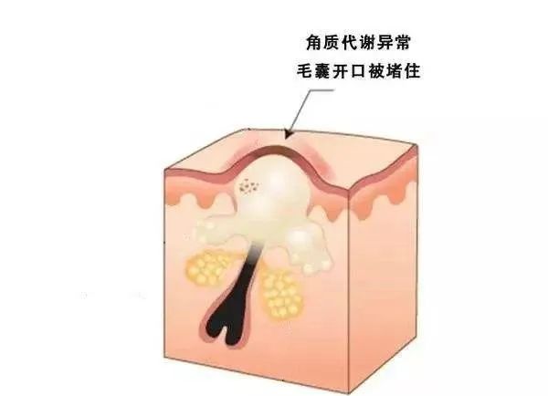 广州肤康皮肤病医院