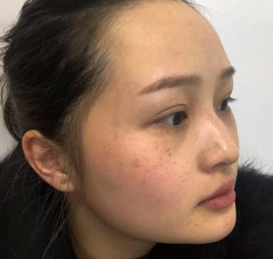 广州肤康皮肤病医院